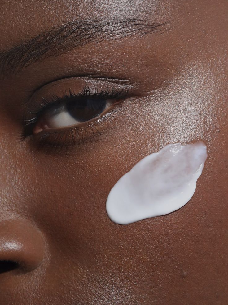 Customized Melanin Skincare Treatments for Black and Brown Skin in Toronto