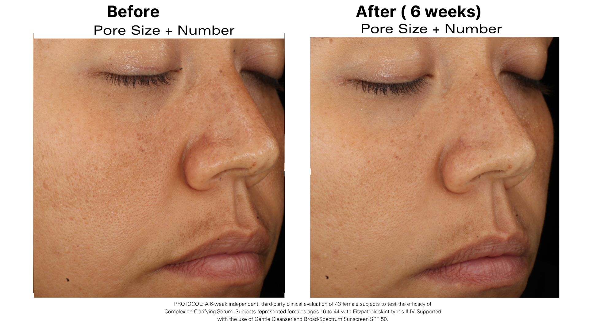 Complexion Clarifying Serum