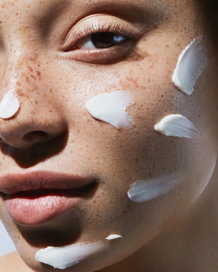 Close-up of a woman with dry skin applying multiple layers of moisturizing skincare, showing cream on cheek and chin